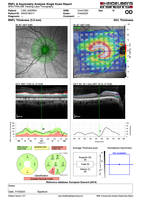 Images médicales du nerf optique et de la pression intraoculaire pour le glaucome.